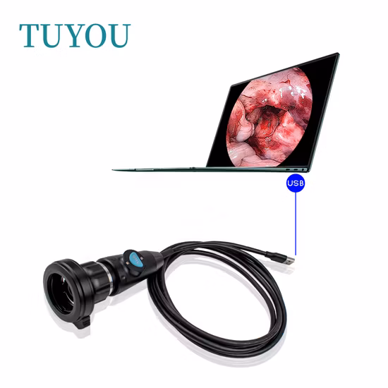 Cámara USB de inspección de endoscopio de cápsula médica portátil para endoscopia Ent